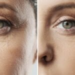 Facelift energetico - rejuvenecimiento facial